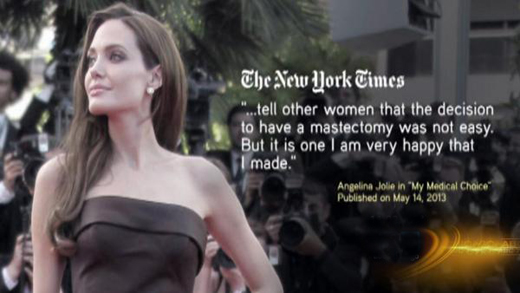 Anjelina jolie-double mastectomy